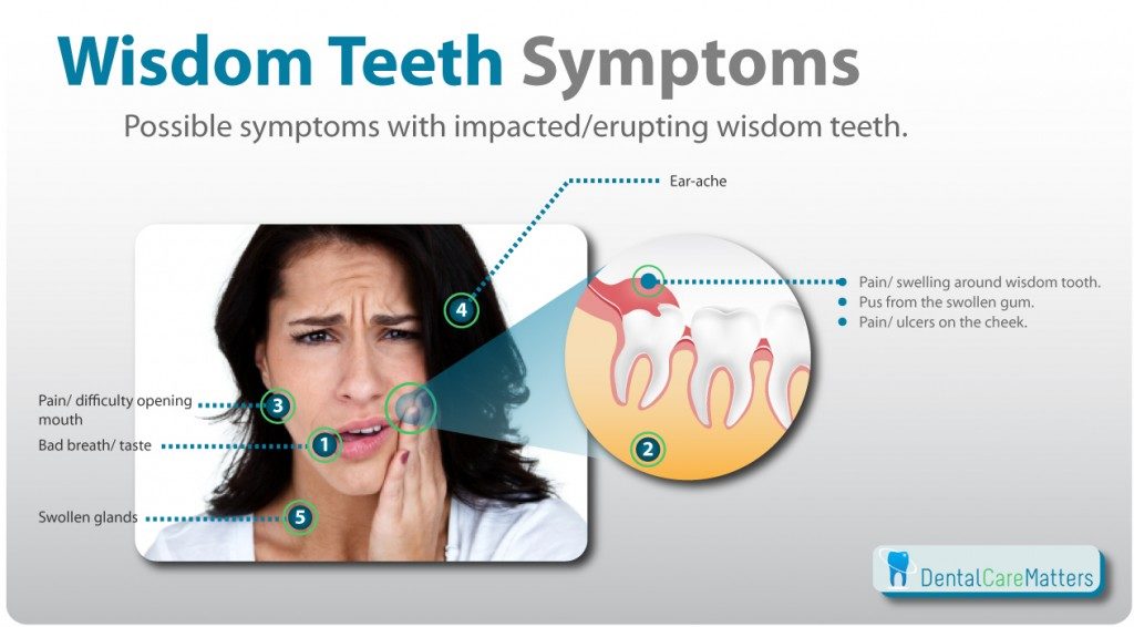 Are Wisdom Teeth Good Or Bad At Debra Fell Blog